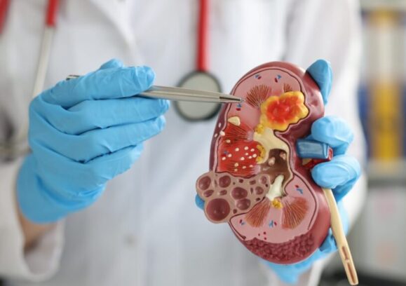 Best Kidney Care Specialists in Agra